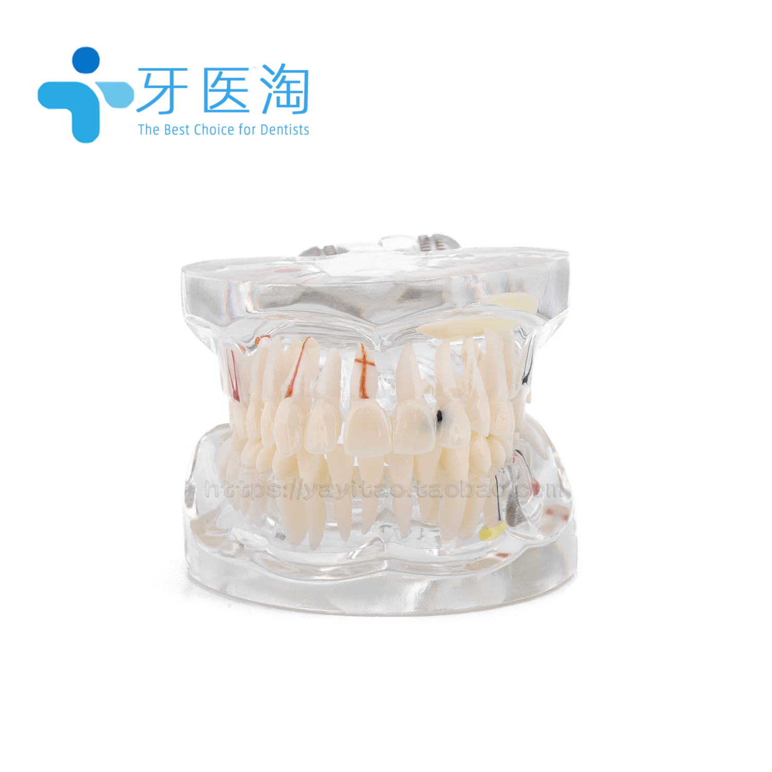 牙科病理模型成人全口医患沟通