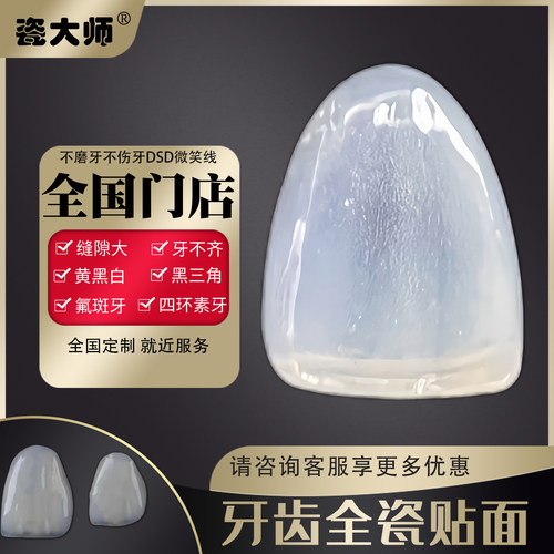 登士柏灵犀瓷全瓷牙齿贴面牙贴片