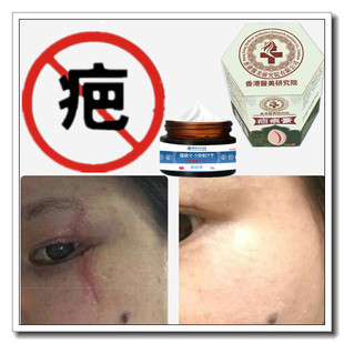 药用草本修复液祛除增生性凹凸疤疙瘩去手术后伤疤痕印灵缝针斑印