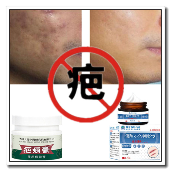 去除儿童冻疮疙瘩修复烟烫烧伤黑色素沉着祛增生性凹凸疤手术巴痕