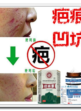 黑色素沉着修复精华贴淡化黑印痘疤痕印去黄抑制色素回流祛除红印