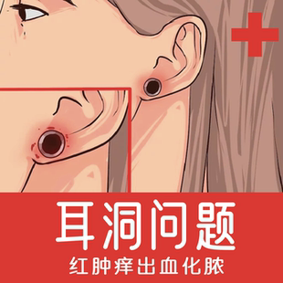 耳点-打耳洞不适感染等问题红肿脓血痒有硬块血包增生舒缓护理液