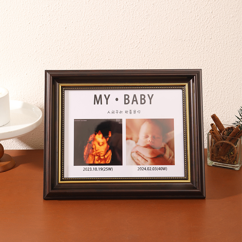 宝宝四维彩超NT孕期B超照片相框