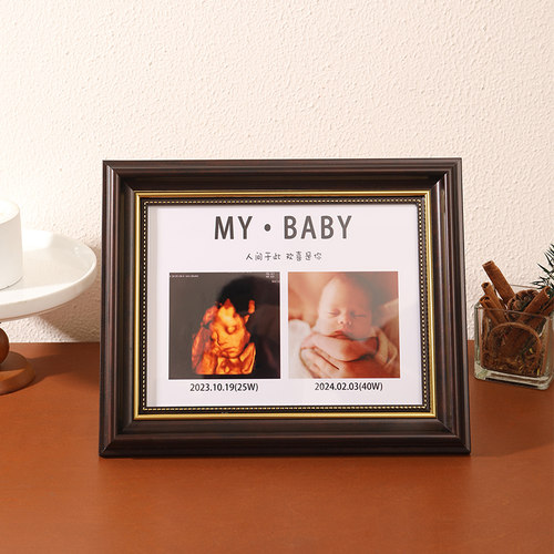 宝宝四维彩超NT孕期B超照片相框