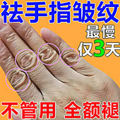 去手指关节皱纹祛除手粗糙干燥手背暗沉黑修复手纹护手霜保湿 嫩肤