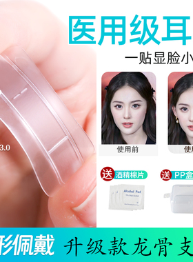 升级龙骨精灵耳贴定型立耳神器女显脸小招风耳隐形固定硅胶强支撑