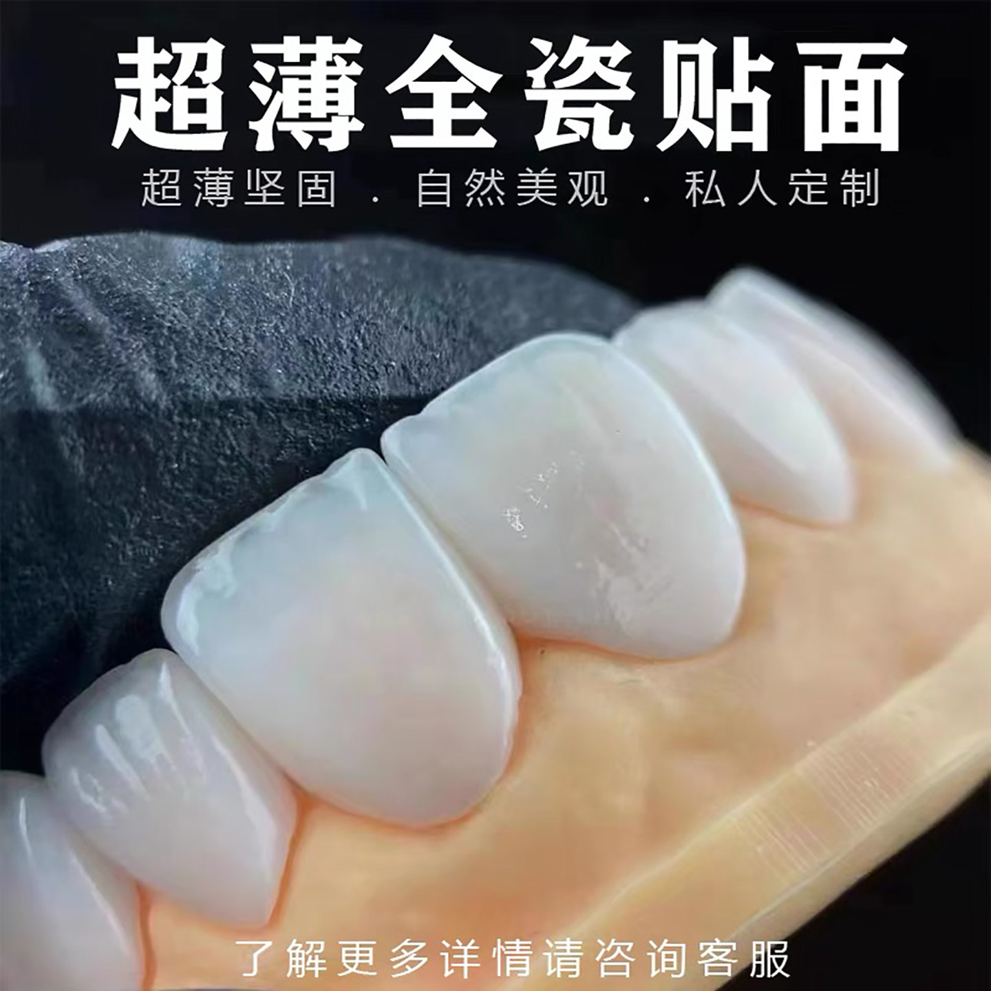全瓷贴面牙齿贴片四环素牙瓜子黑三角氟斑牙全瓷牙贴美白定制
