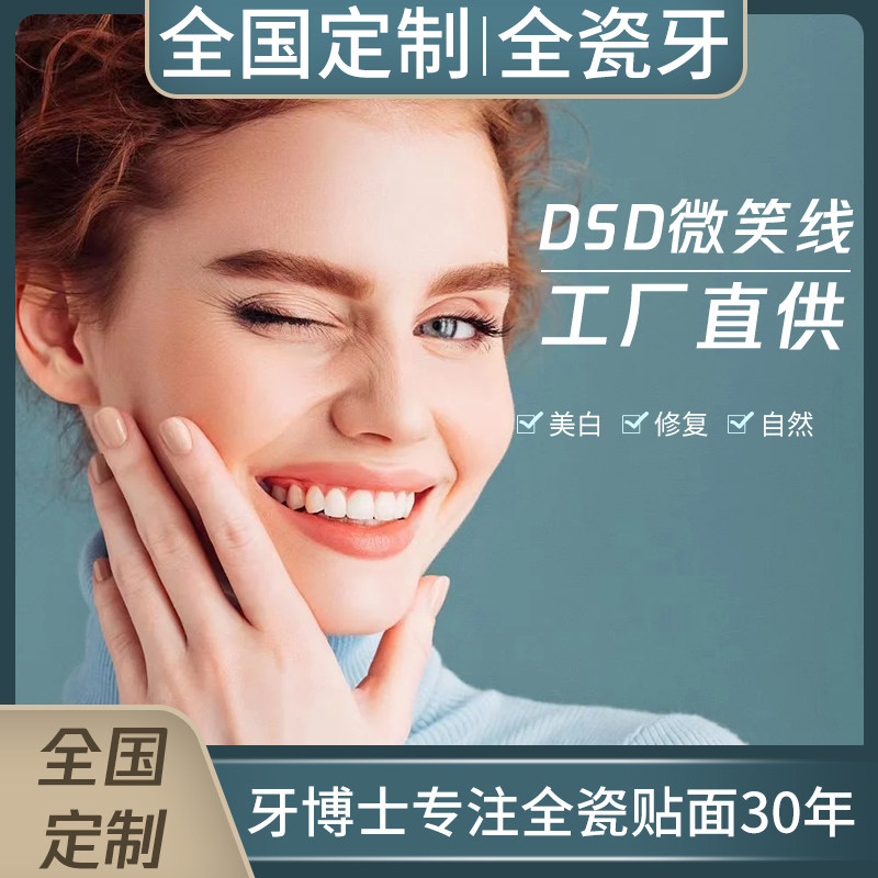 全国定制进口全瓷贴面全瓷美牙美白连桥牙马里兰桥连冠微贴片