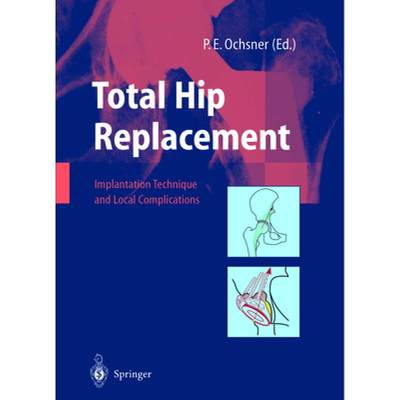 【4周达】Total Hip Replacement: Implantation Technique and Local Complications [9783642628689]