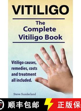【3-4周达】Vitiligo. Vitiligo causes, remedies, costs and treatment all included. The complete Vitili... [9781910410844]