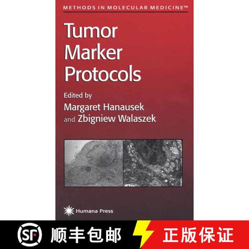 【3-4周达】Tumor Marker Protocols [9781617370199]