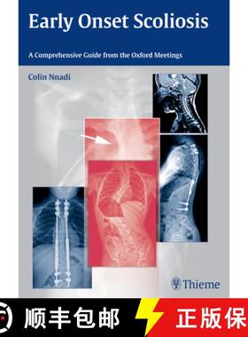 【3-4周达】Early Onset Scoliosis: A Comprehensive Guide from the Oxford Meetings [9783131726612]