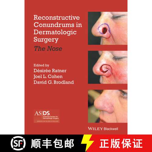 【3-4周达】精装 Reconstructive Conundrums In Dermatologic Surgery - The Nose [Wiley医学] [9781118272329]