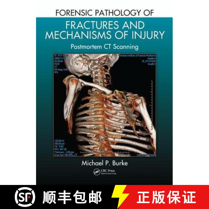 【3-4周达】Forensic Pathology of Fractures and Mechanisms of Injury: Postmortem CT Scanning [9781439881484]
