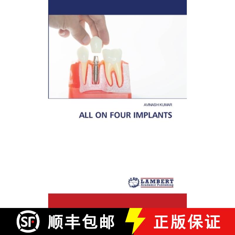 【2-3周达】All on Four Implants [9786208225308]