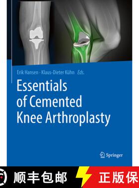 【3-4周达】Essentials of Cemented Knee Arthroplasty [9783662631157]
