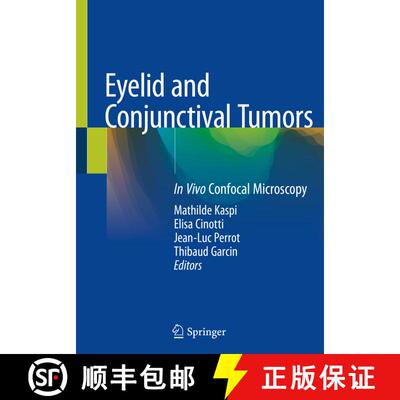 【3-4周达】Eyelid and Conjunctival Tumors: In Vivo Confocal Microscopy [9783030366087]