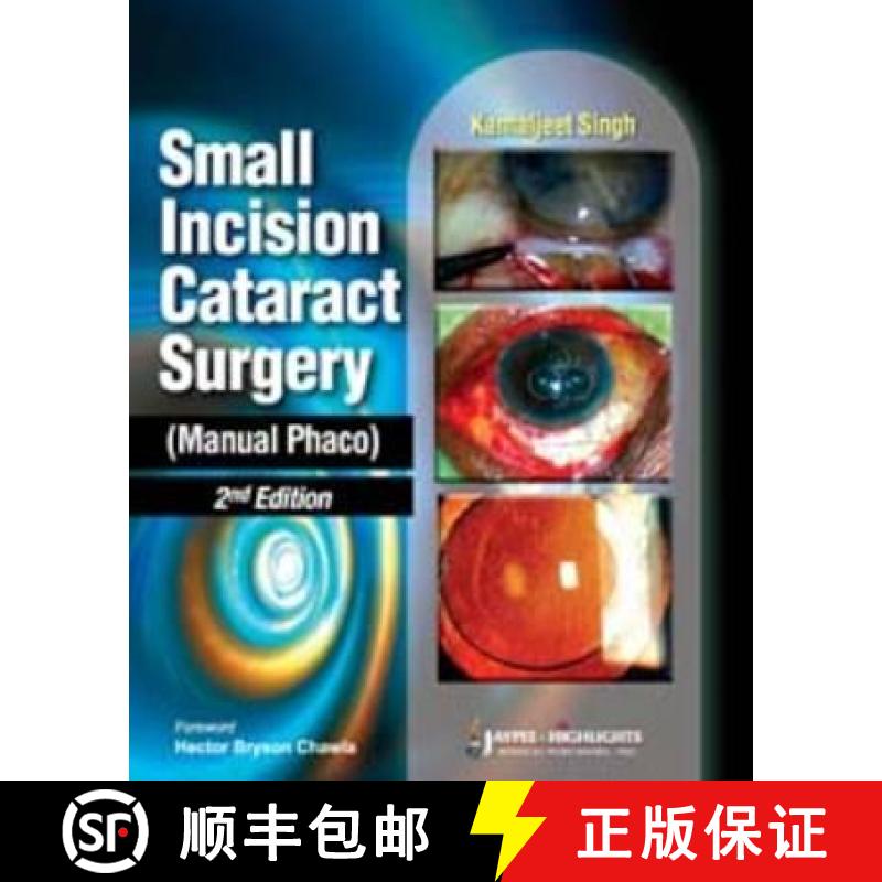 【2-3周达】Small Incision Cataract Surgery (Manual Phaco) [9788184489804]