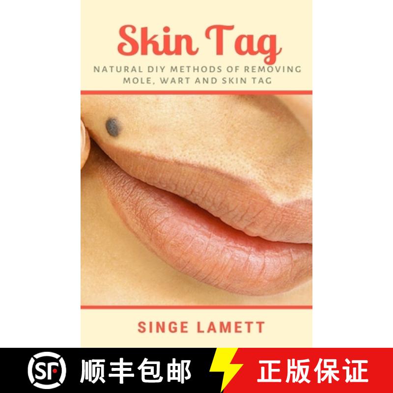 【3-4周达】Skin Tag : Natural DIY Methods of removing Mole, Wart and Skin Tag [9781637502570]