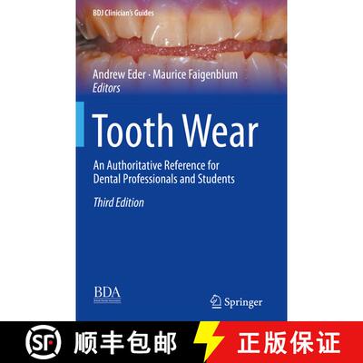 【3-4周达】Tooth Wear: An Authoritative Reference for Dental Professionals and Students (Third Editio... [9783030861124]
