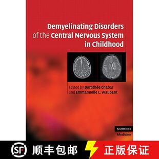 【3-4周达】Demyelinating Disorders of the Central Nervous System in Childhood [9780521763493]