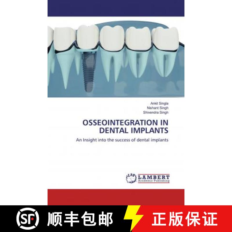 预订 OSSEOINTEGRATION IN DENTAL IMPLANTS [9786200470485]