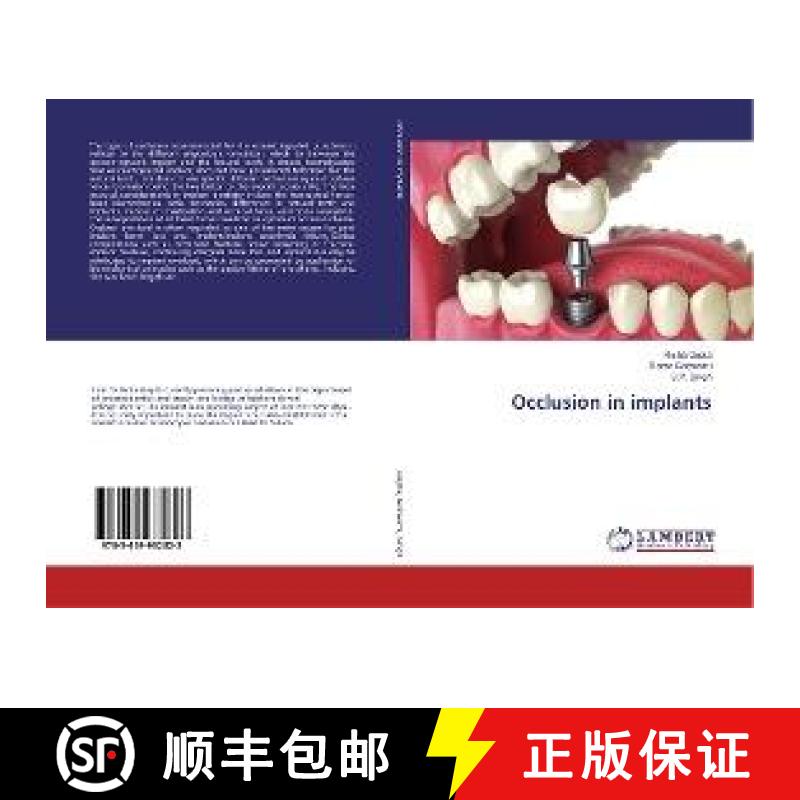 预订 Occlusion in implants [9783659932823]