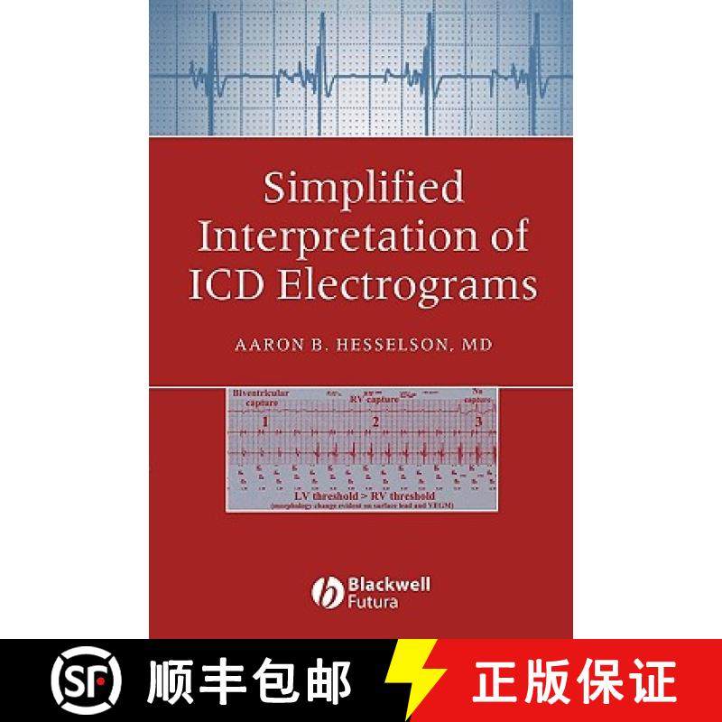 【3-4周达】Simplified Interpretation Of Icd Electrograms [Wiley医学] [9781405127318]