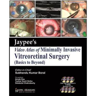 【4周达】Jaypee's Video Atlas of Minimally Invasive Vitreoretinal Surgery (Basics to Beyond) [9789350902004]