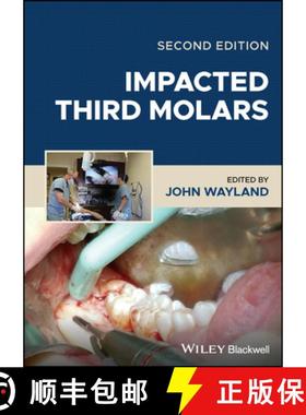 【3-4周达】Impacted Third Molars [9781119930303]