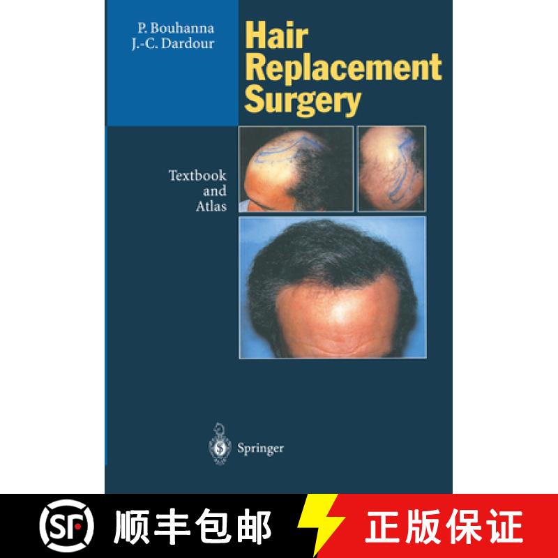 【3-4周达】Hair Replacement Surgery: Textbook and Atlas [9783642796142]