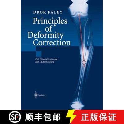 【3-4周达】Principles of Deformity Correction [9783642639531]