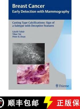 【3-4周达】Casting-Type Calcifications: Sign of a Subtype with Deceptive Features [9783131353917]