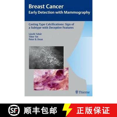 【3-4周达】Casting-Type Calcifications: Sign of a Subtype with Deceptive Features [9783131353917]