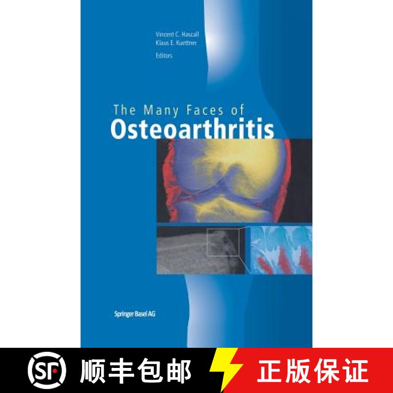 【3-4周达】The Many Faces of Osteoarthritis [9783034894500]