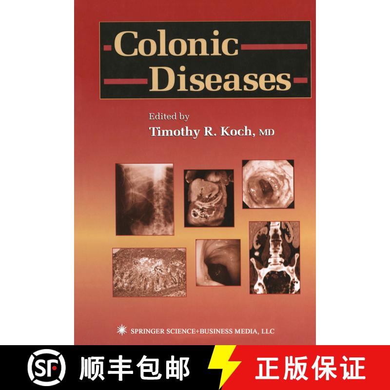 【3-4周达】Colonic Diseases [9781468497403] - 实物图