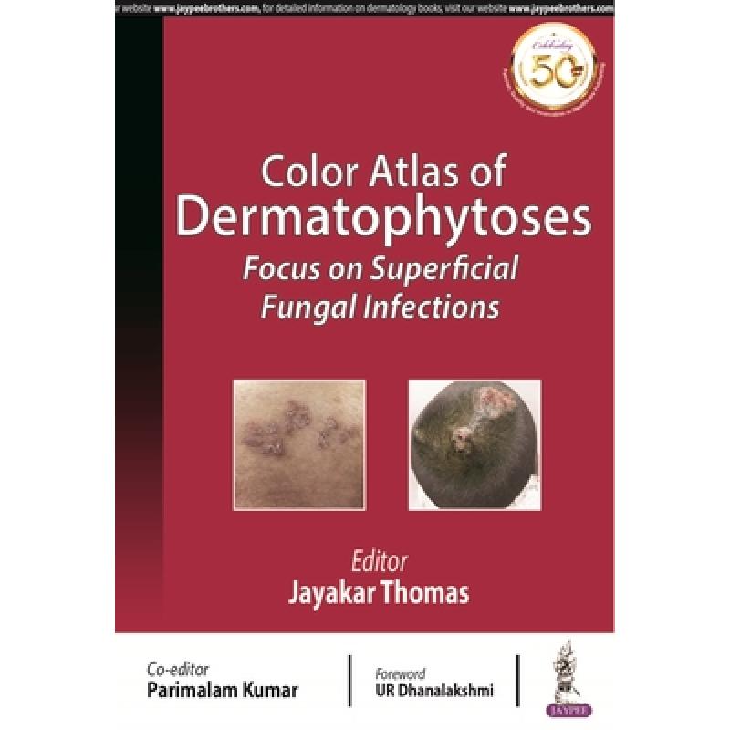 预订 Color Atlas of Dermatophytoses : Focus on Superficial Fungal Infections [9789389188387]