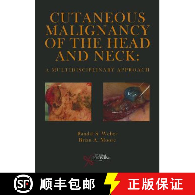 【4周达】Cutaneous Malignancy of the Head and Neck : A Multidisciplinary Approach [9781597563383]