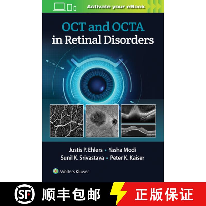【3-4周达】Oct and Oct Angiography in Retinal Disorders [9781975144227]