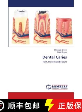 预订 Dental Caries [9786200539717]