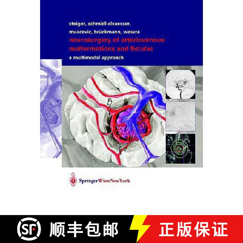 【4周达】Neurosurgery of Arteriovenous Malformations and Fistulas: A Multimodal Approach [9783211837030]
