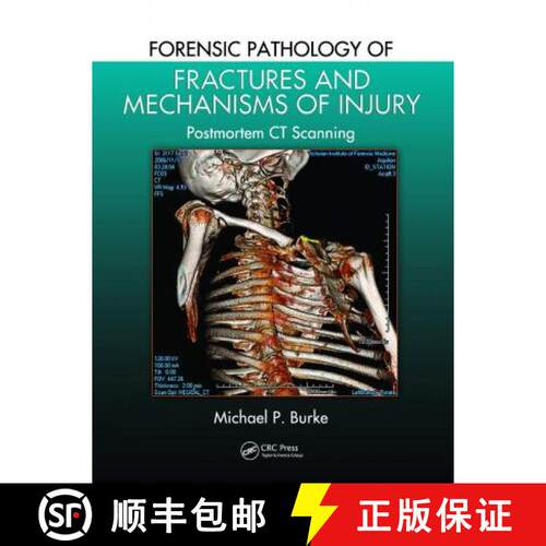 【3-4周达】Forensic Pathology of Fractures and Mechanisms of Injury: Postmortem CT Scanning [9780367778194]