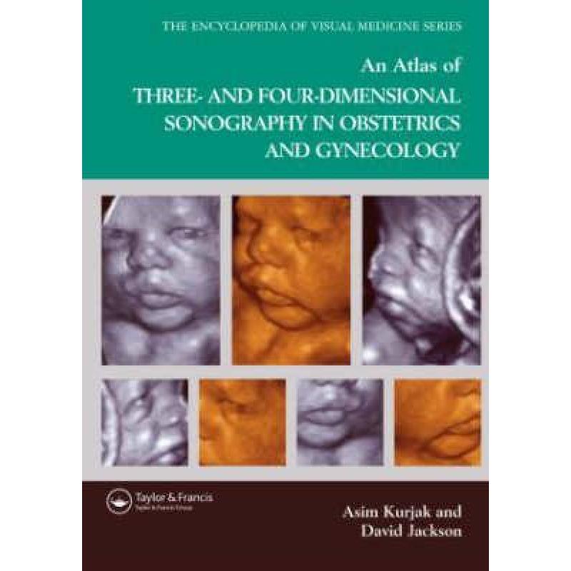 【4周达】An Atlas of Three- And Four-Dimensional Sonography in Obstetrics and Gynecology [9781842142387] 书籍/杂志/报纸 原版其它 原图主图