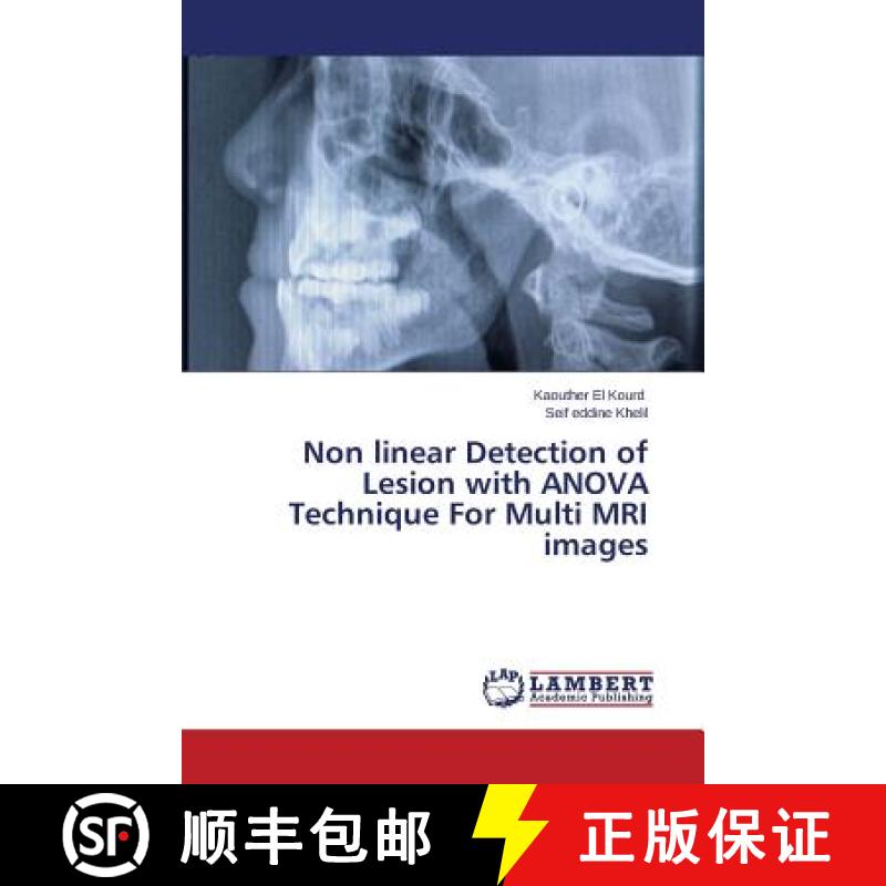 预订 Non Linear Detection of Lesion with Anova Technique for Multi MRI Images [9783659592416]