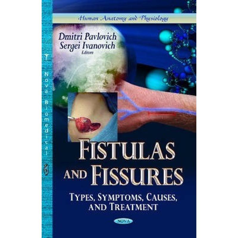 【4周达】Fistulas and Fissures: Types, Symptoms, Causes, and Treatment [9781626180680] 书籍/杂志/报纸 科学技术类原版书 原图主图