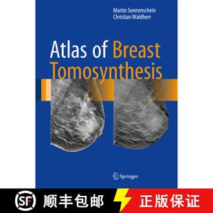 Atlas 9783319215655 Interventions Findings 4周达 and Breast Guided Tomosynthesis Image Imaging
