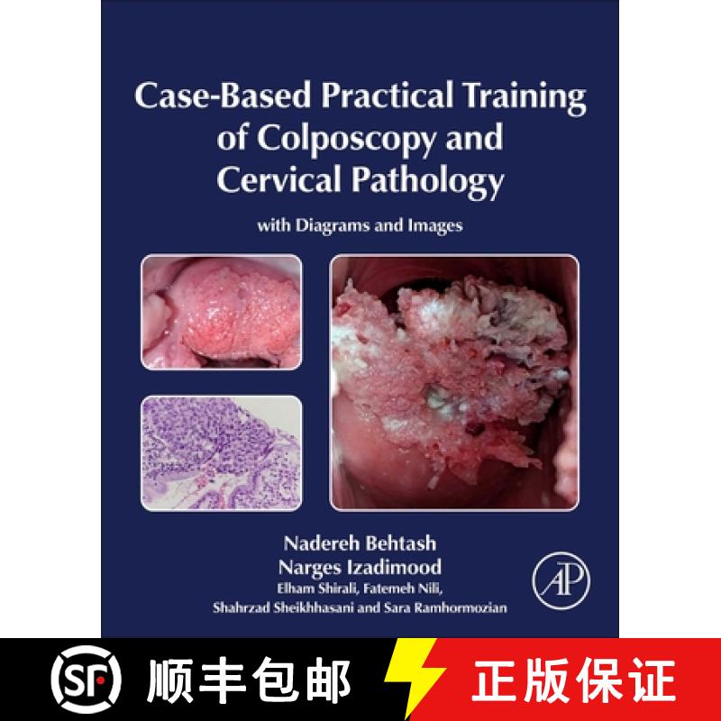【3-4周达】Case-Based Practical Training of Colposcopy and Cervical Pathology: With Diagrams and Images [9780443247941]