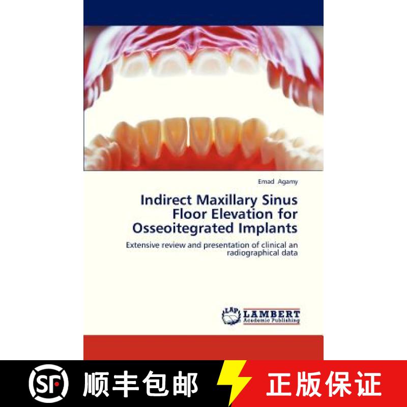 预订 Indirect Maxillary Sinus Floor Elevation for Osseoitegrated Implants [9783659321955]