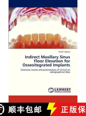 预订 Indirect Maxillary Sinus Floor Elevation for Osseoitegrated Implants [9783659321955]