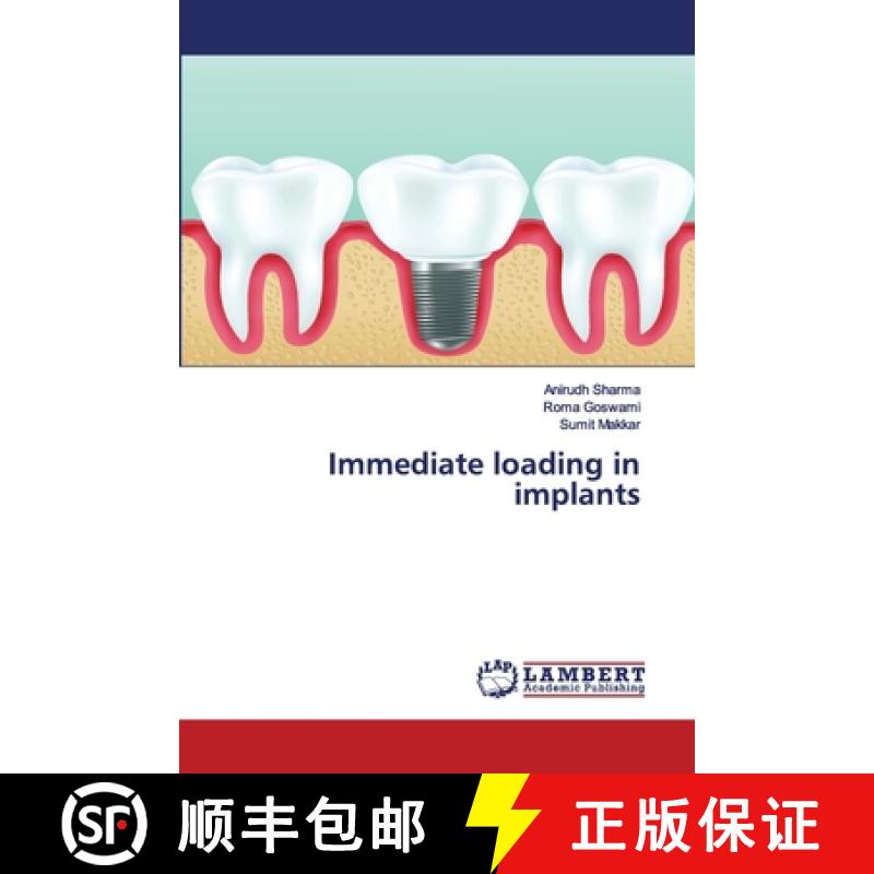 预订 Immediate loading in implants [9786200249050]